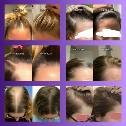 Shampoo Antiqueda e Tônico | DHT™